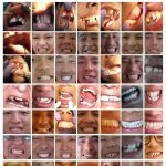 Dental Project 2015